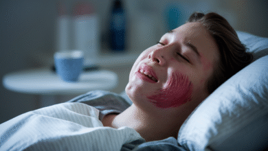 Worst Day of Pain After Wisdom Tooth Extraction: What to Expect and How to Feel Better