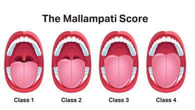 Mallampati score
